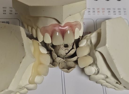 Dentadura invisível macia confortável do ajuste ISO13485 RPD