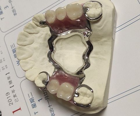 Estrutura parcial do metal da dentadura da liga Maxillary do Cr do Co do arco