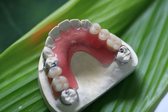 Dentadura invisível flexível parcial para os dentes anteriores