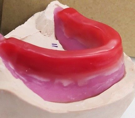 Trushine dental grava blocos para dentaduras completas finais