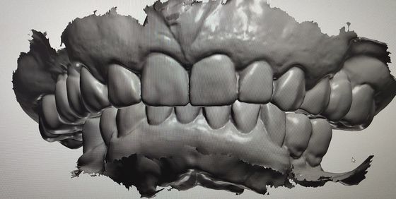 Dentes do modelo da indicação digital do projeto do CAD CAM outros produtos dentais