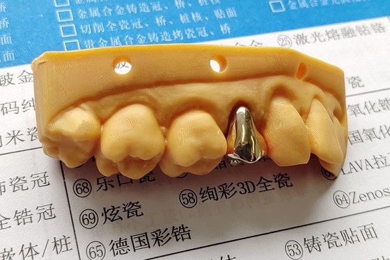 Coroa dental do metal completo nobre alto do ouro