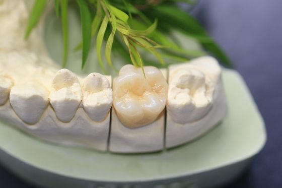 Da zircônia monolítica dental do laboratório do projeto coroa dental para os dentes traseiros dos molares